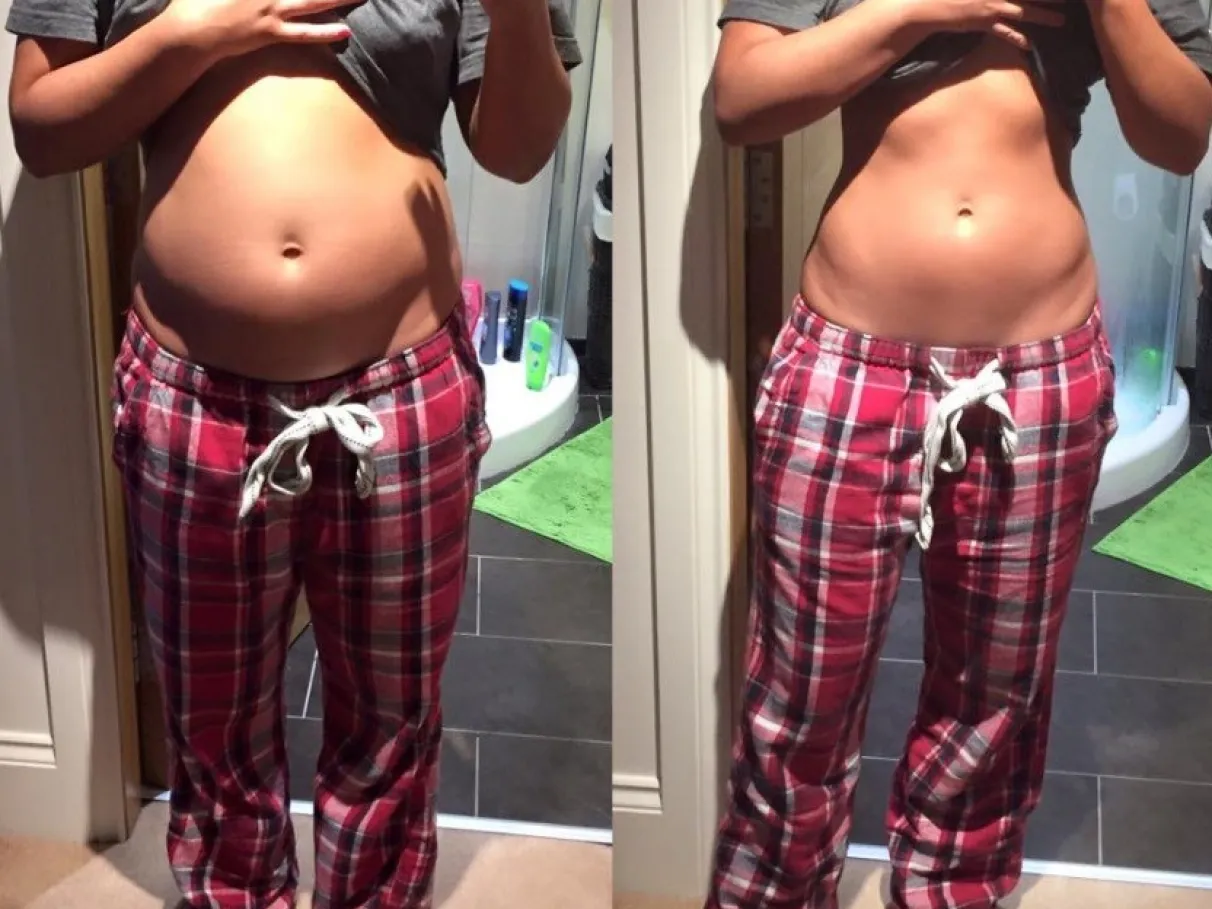 Antes e depois — barriga menos inchada após o ritual Balance